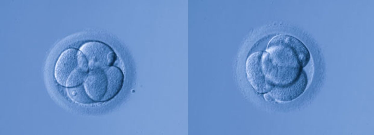 Briten erlauben Genmanipulation von Embryos