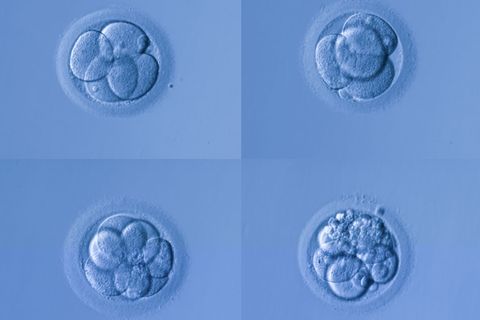 Briten erlauben Genmanipulation von Embryos
