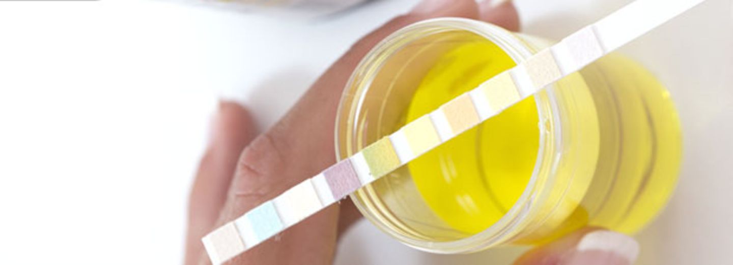 Farbskala: Was die Farbe deines Urins über deine Gesundheit aussagt