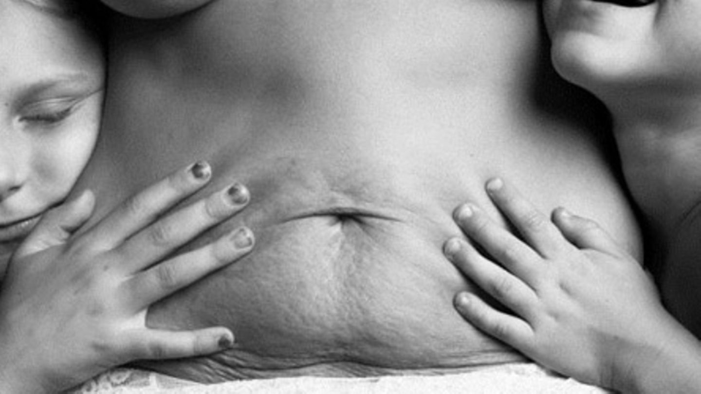 Schlaffe Haut nach Schwangerschaft - DIESE MarathonlÃ¤uferin macht Frauen Mu...