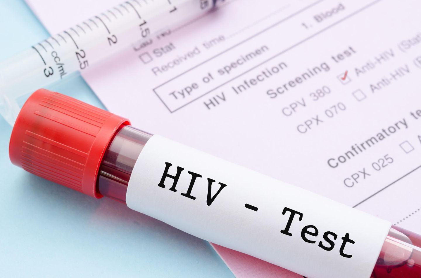 Leben mit der Diagnose HIV: Eine junge Frau erzählt