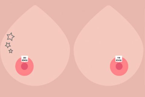 "Free the nipple!" - der Oben-ohne-Protest geht weiter