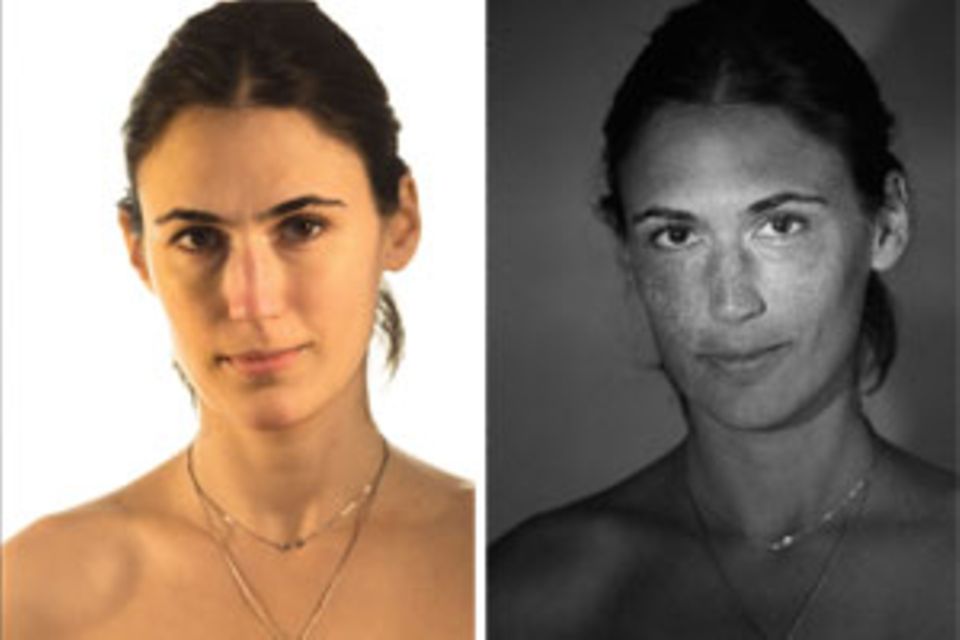 Bei Tageslicht ist der Teint des Models noch unauffällig, im UV-Licht sieht man bereits die Sonnenschädigungen als Punkte. Bei Tageslicht ist der Teint des Models noch unauffällig, im UV-Licht sieht man bereits die Sonnenschädigungen als Punkte.