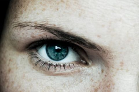Die Augen lasern lassen: Ein Erfahrungsbericht