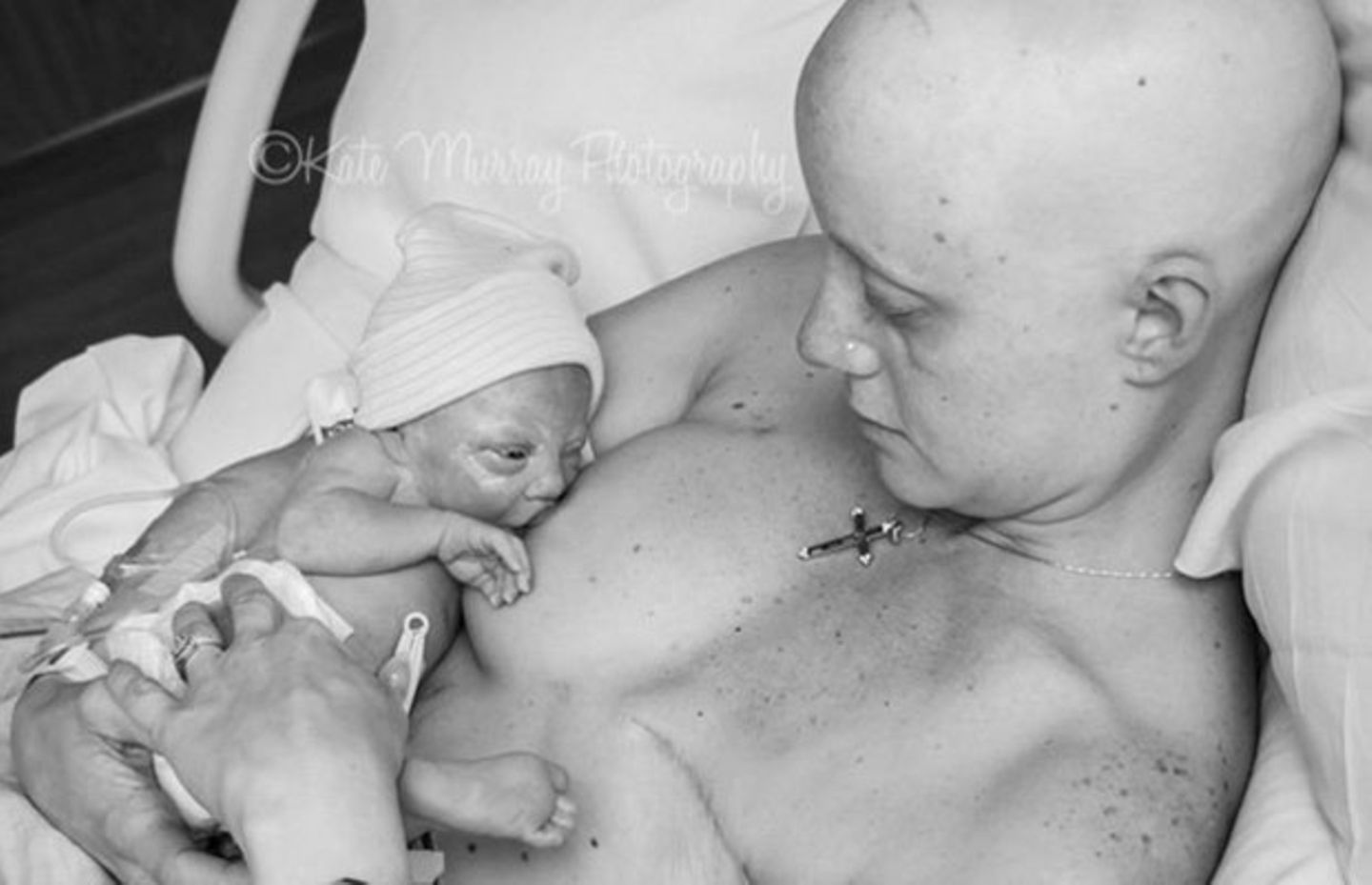 Nach der Krebsdiagnose: Diese Bilder feiern das Leben