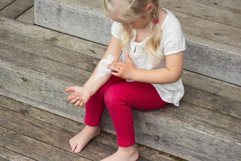 Neurodermitis bei Kindern – was hilft?