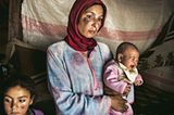 Auch Mahed Ali Hassan ist im Libanon gestrandet, sie leidet unter Leishmaniose, einer durch Parasiten ausgelösten Infektion, die in den Flüchtlingscamps grassiert.