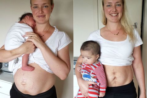 Ihre "After-Baby-Body"-Bilder rühren die Welt