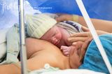 Kaiserschnitt: "Bei Geburten gibt es kein Richtig oder Falsch!"