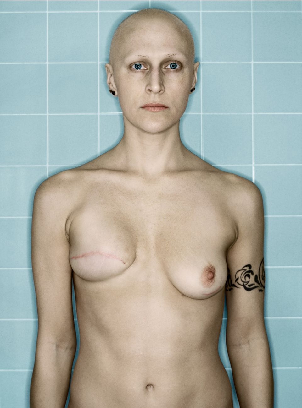 Selbstporträts: Von der Diagnose bis zur Brustamputation