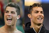 Christiano Ronaldo mit alten und neuen Zähnen