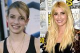 Emma Roberts mit Zähnen im Vorher/Nachher-Vergleich