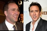 Nicolas Cage mit Zähnen Vorher/Nachher