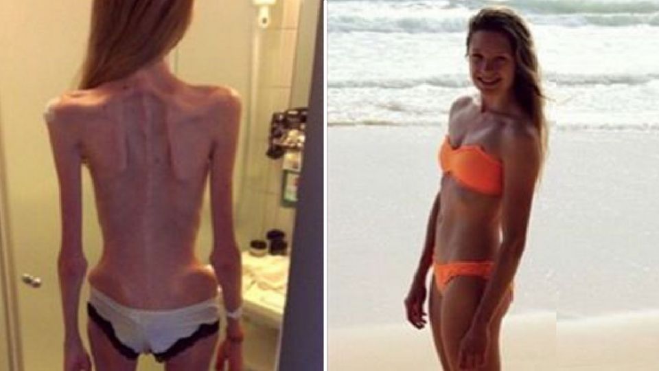 Mutiges Foto: Diese Frau macht sich jeden Tag in die Hose Mutiges Foto: Diese Frau macht sich jeden Tag in die Hose