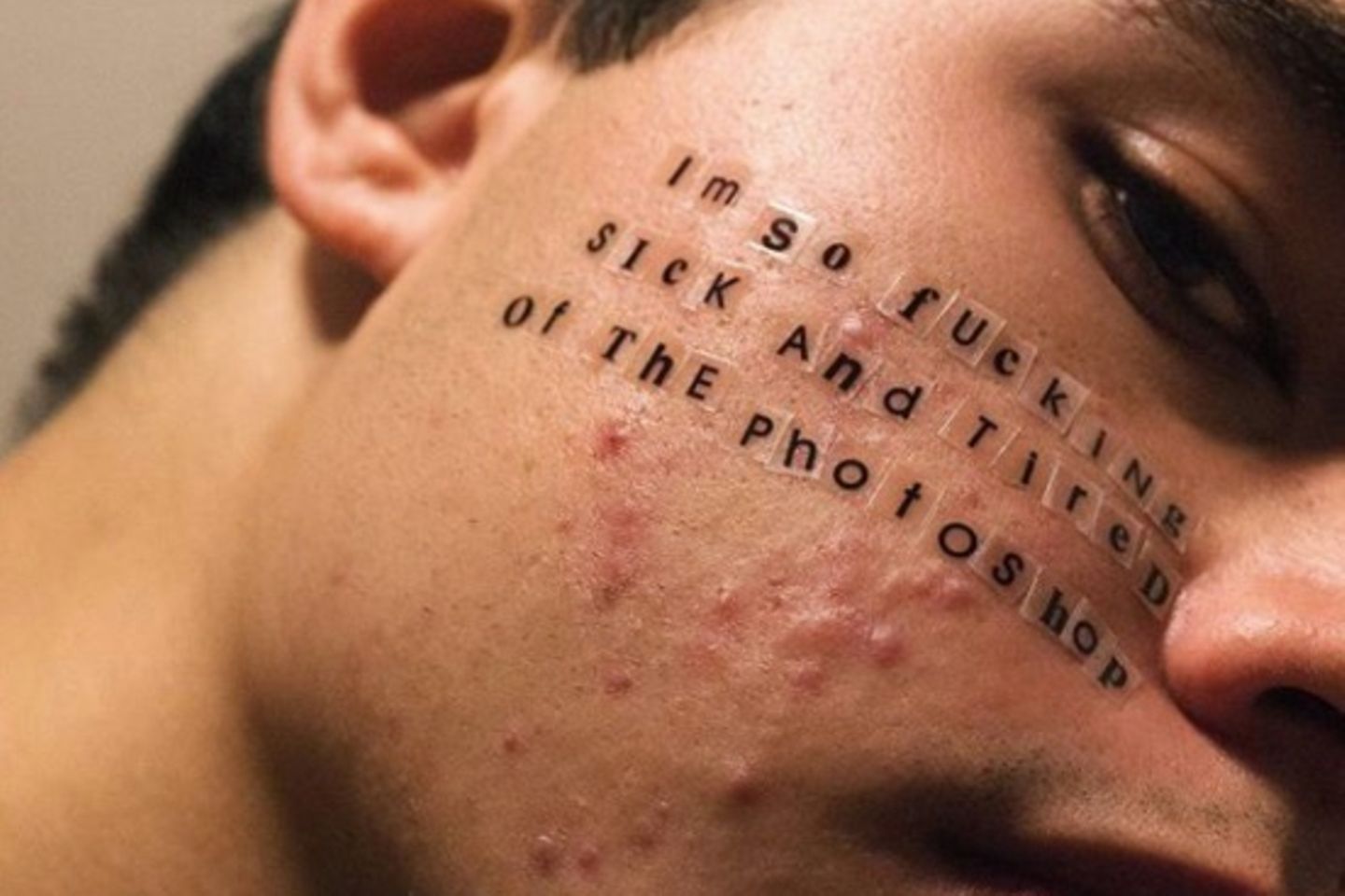 Mann mit Akne und Anti-Photoshopschrift