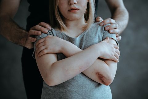 Strähnchen gefärbt: Vater schneidet Tochter zur Strafe die Haare