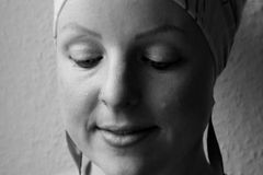 "Ich bin einfach auf eine andere Art schön" – Wie es ist, ohne Haare zu leben "Ich bin einfach auf eine andere Art schön" – Wie es ist, ohne Haare zu leben