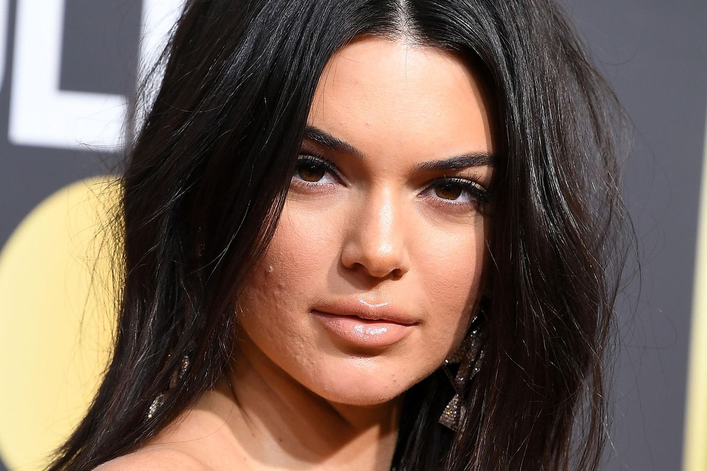 Instagram-Trend: Kendall Jenner mit Hautunreinheiten