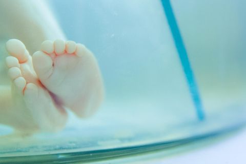 Abtreibung: Baby-Füße im Reagenzglas