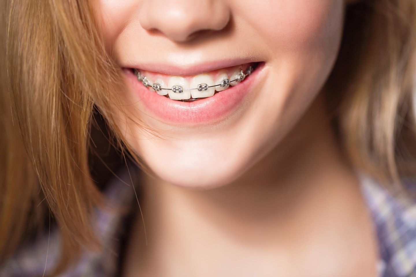 Zahnspange: Mädchen mit Zahnspange