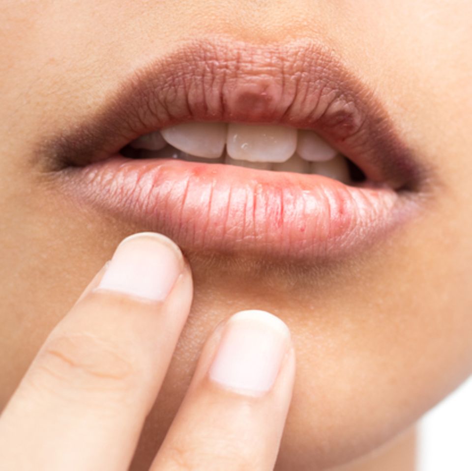 CARMEX Lippenbalsam Für Trockene Lippen – 7,5 G Tube, Pflegend & Beruhigend