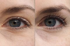 Wimpernserum Jeuxloré im Test: Vorher vs. Nachher! Wimpernserum Jeuxloré im Test: Vorher vs. Nachher!