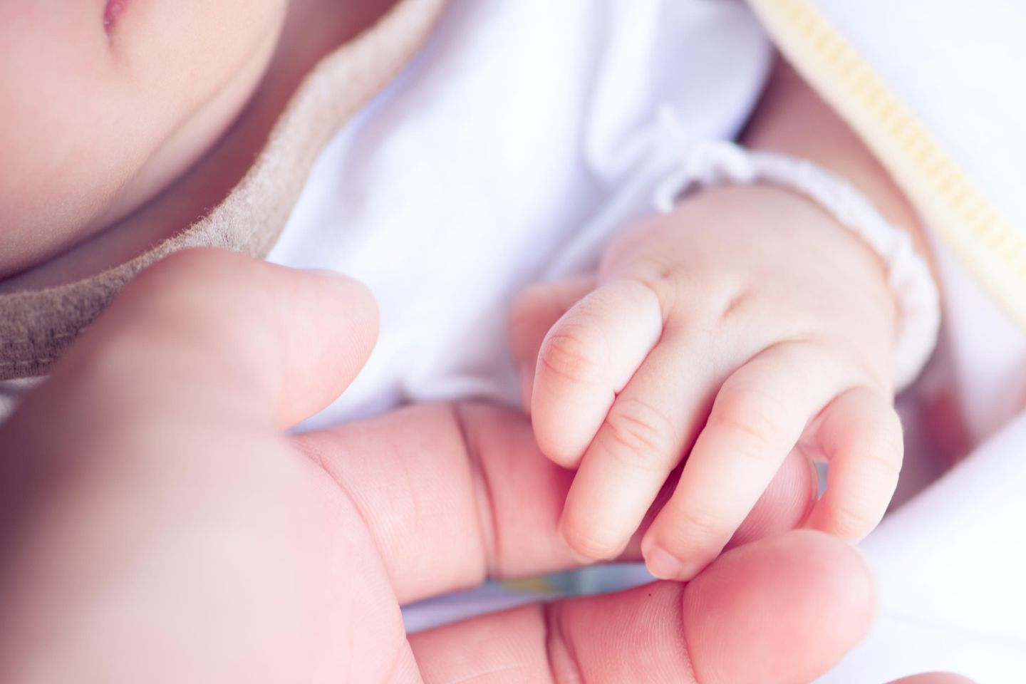 Instagram: Mutter schockiert nach Geburt wegen Feuermal