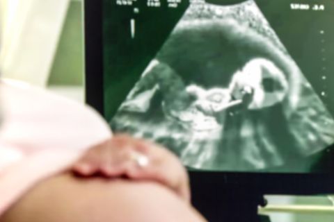 Sandra Kuhn: Im Ultraschall wurde schwarzer Fleck auf dem Gehirn ihres Babys entdeckt