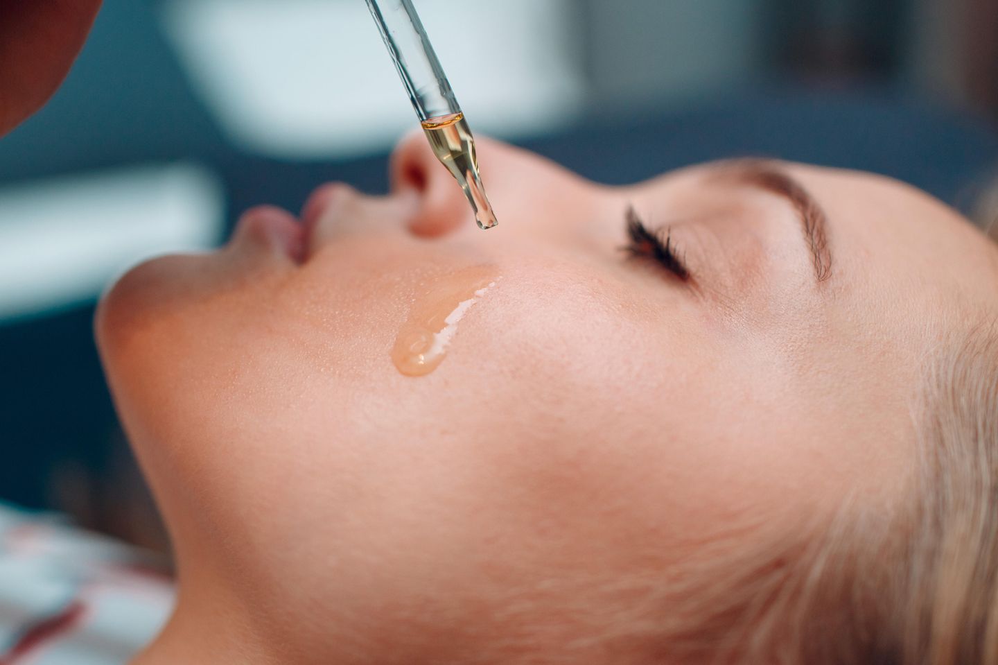 Gesichtsöl für unreine Haut: Öl, das aus einer Pipette auf das Gesicht tropft