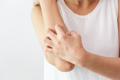 Neurodermitis Symptome: Person kratzt sich mit Händen am Unterarm
