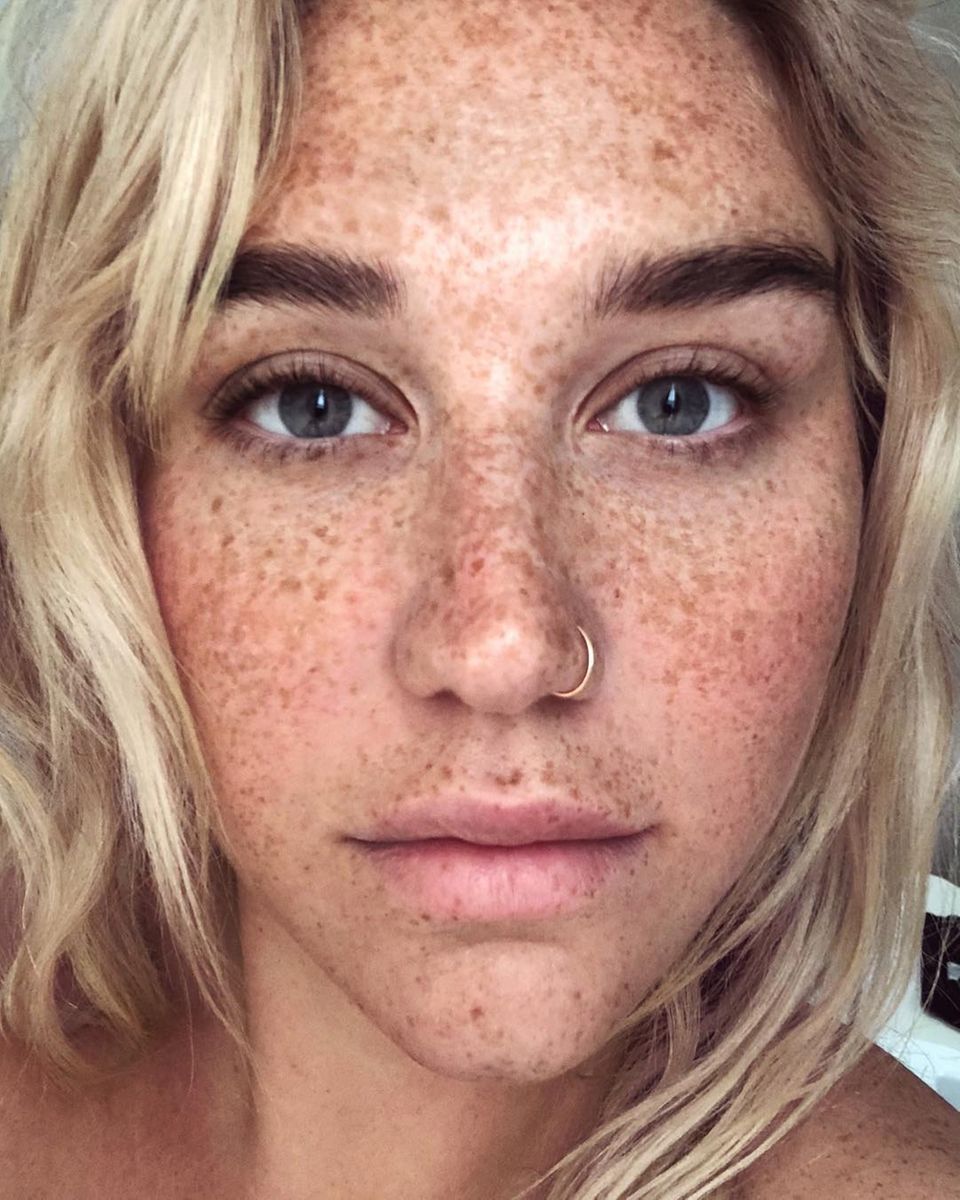 Stars ohne Make-up: Kesha mit Sommersprossen