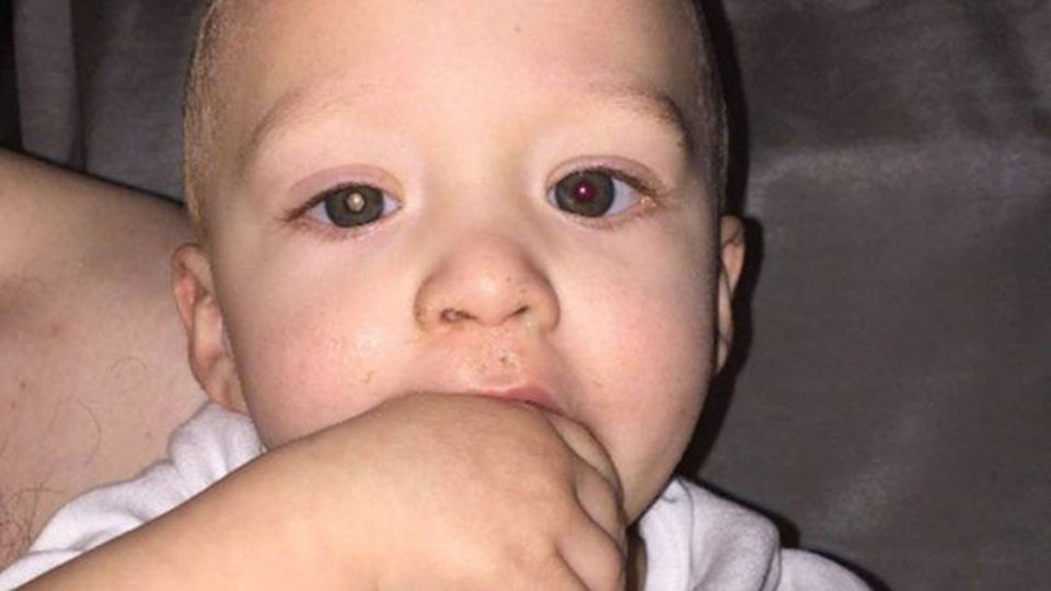 Foto von Kind: Mutter enthüllt tödliche Krankheit Foto von Kind: Mutter enthüllt tödliche Krankheit