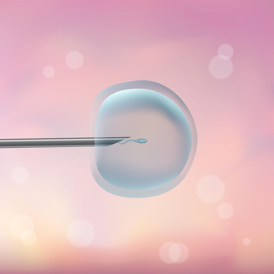 ICSI: Nadel mit Spermium in Eizelle