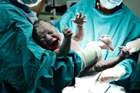 Kaiserschnitt-Mama wider Willen: Über das Gefühl, versagt zu haben