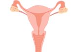 Gebärmutterhalskrebs: Grafik Gebärmutter