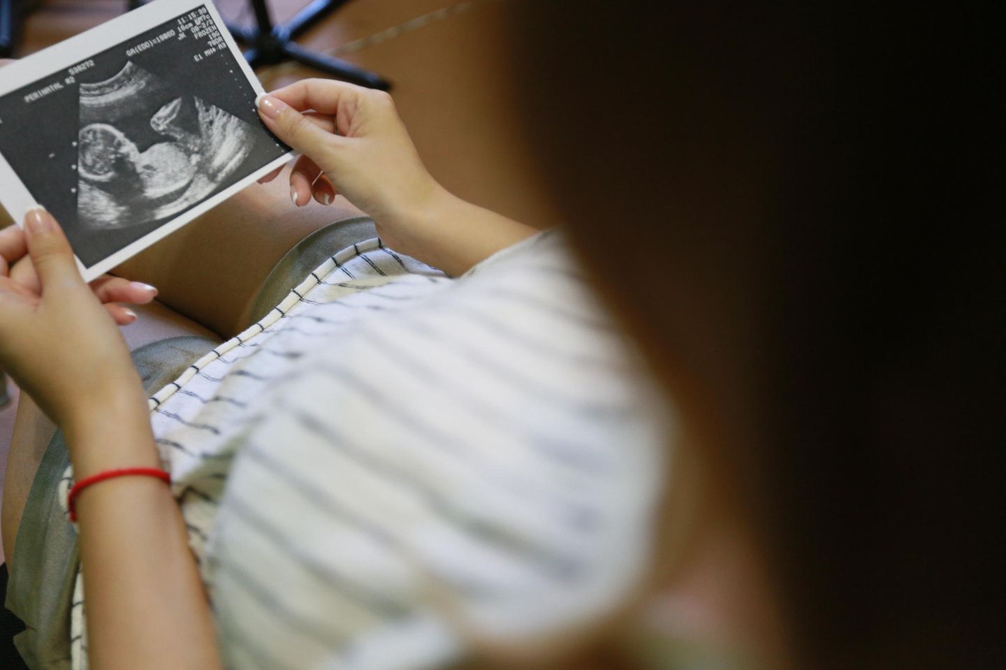 USA: Neue Studie hat untersucht, wie es Frauen nach Abtreibungen geht: Frau hält Ultraschallbild