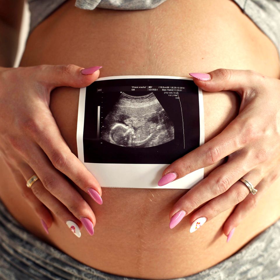 Nail Art für Schwangere: Mini-Ultraschallbild auf dem Fingernagel: Frau mit Ultraschallbild