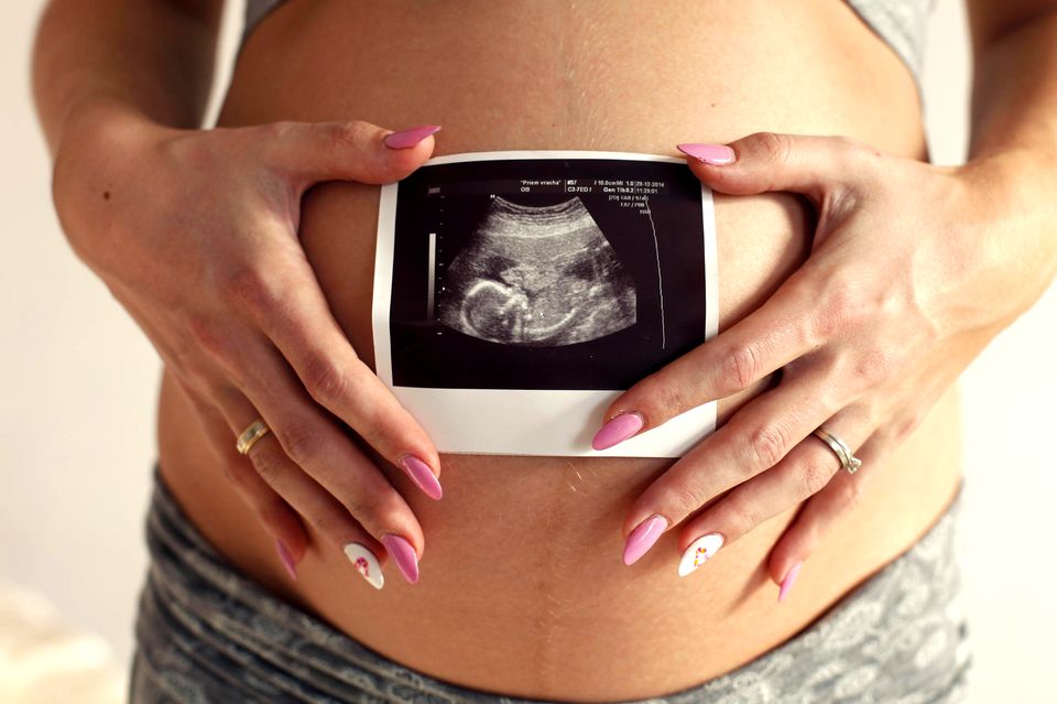 Nail Art für Schwangere: Mini-Ultraschallbild auf dem Fingernagel: Frau mit Ultraschallbild