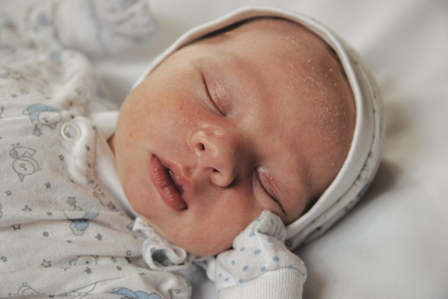 Milchschorf: Schlafendes Baby