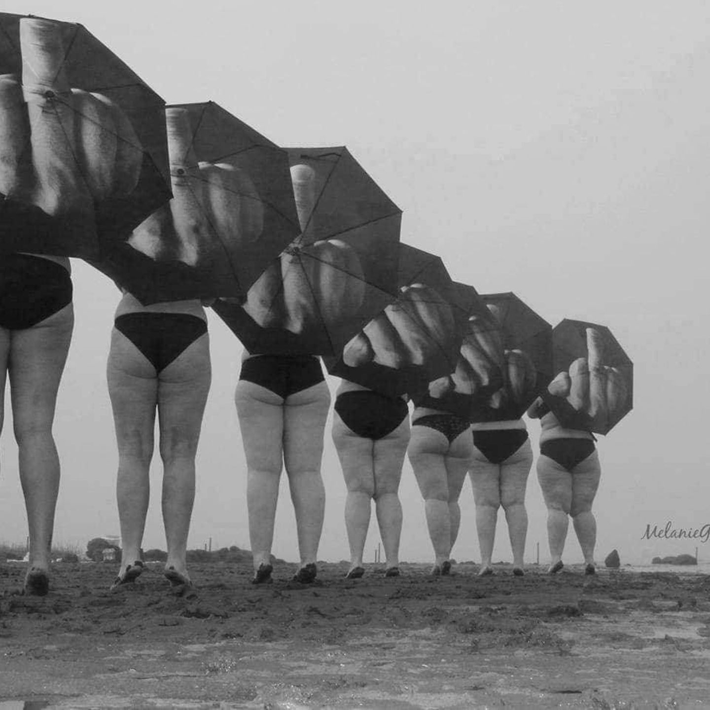 "Lipödem ist ein Arschloch heißt das Fotoprojekt von Melanie Lorenz