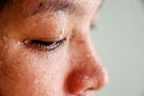 Starkes Schwitzen am Kopf: Frau schwitzt im Gesicht