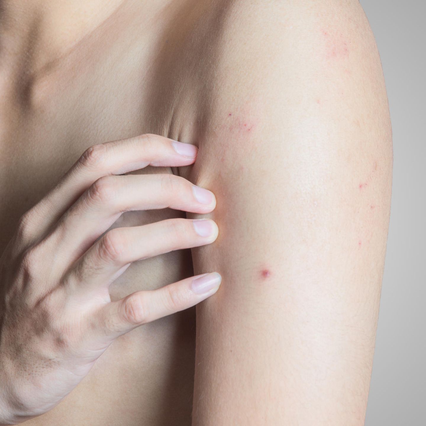 Sind diese roten Punkte auf der Haut gefährlich? Das solltest du darüber  wissen! - YouTube
