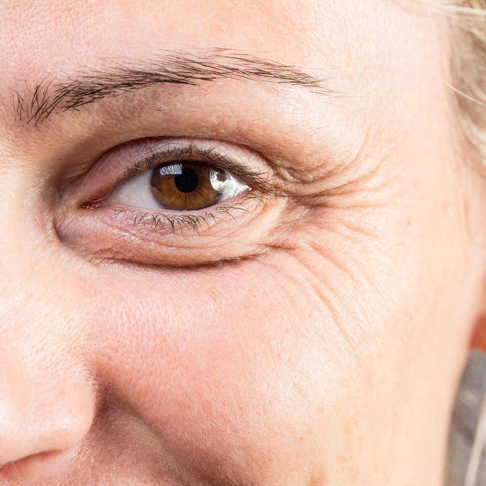 Falten im Gesicht: Frau mit Augenfalten
