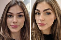 Brow Lifting Vorher (l.) vs. nachher. Die Augenbrauen sehen nach dem Treatment deutlich voller und geliftet aus.