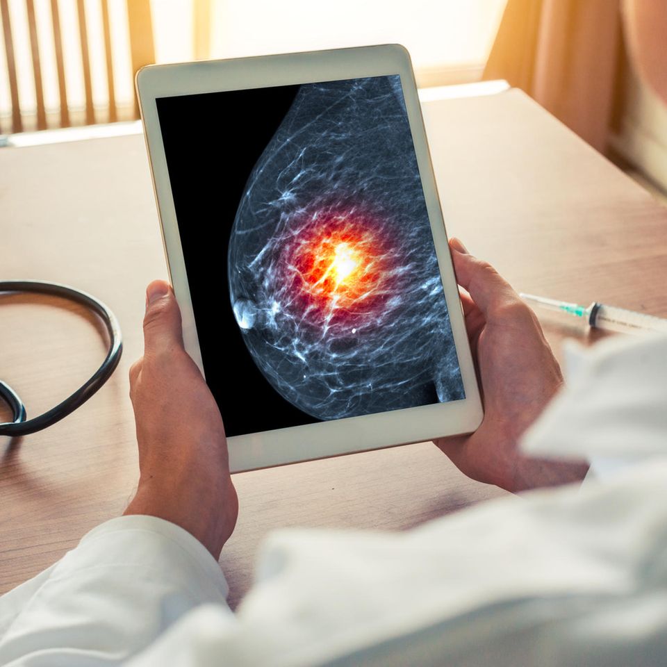 Moderatorin bekommt bei Live-Mammographie Diagnose