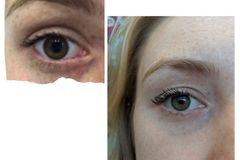 Links: Vorher, Rechts: Nachher. Links: Vorher, Rechts: Nachher.