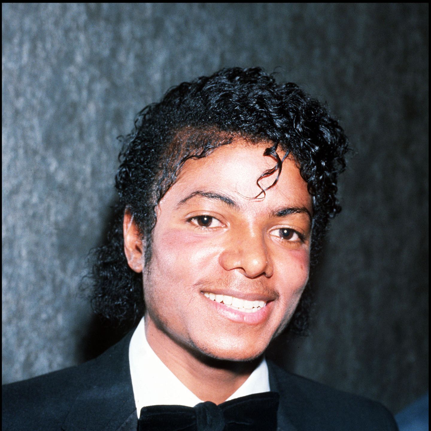 Eine Haut wie Michael Jackson: Vitiligo | BRIGITTE.de