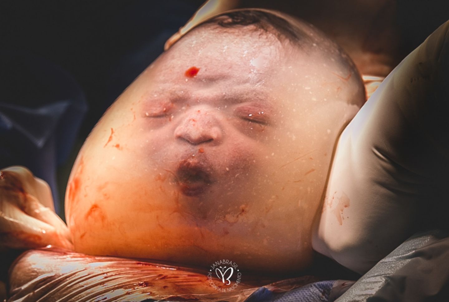 Geburtsfotos 2020: Baby in Fruchtblase
