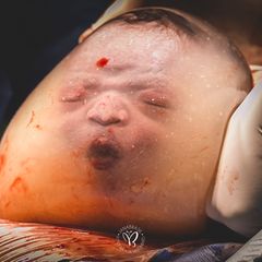 Geburtsfotos 2020: Baby in Fruchtblase