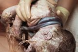 Geburtsfotos 2020: Neugeborenes mit Nabelschnur
